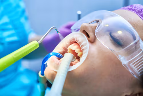 Patient undergoing dental procedure with air abrasion tool and suction device in mouth, wearing protective glasses.
