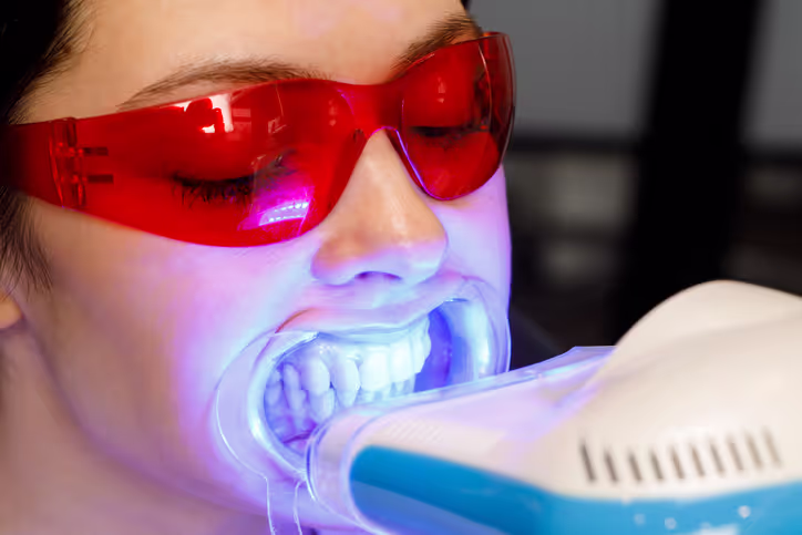 Person wearing red protective glasses undergoing teeth whitening treatment with a dental light device.